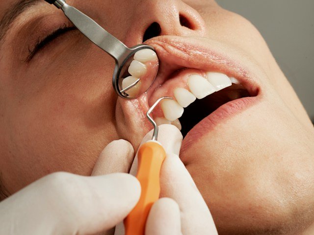 Close-up of healthy teeth and tooth enamel illustrating natural remineralization and protection against early decay.