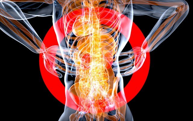 Illustration showing low-grade inflammation affecting blood vessels and body tissues alongside healthy lifestyle elements such as nutrition, exercise, and sleep.